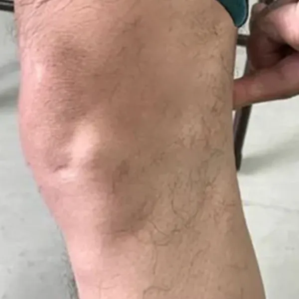 Customer knee image
